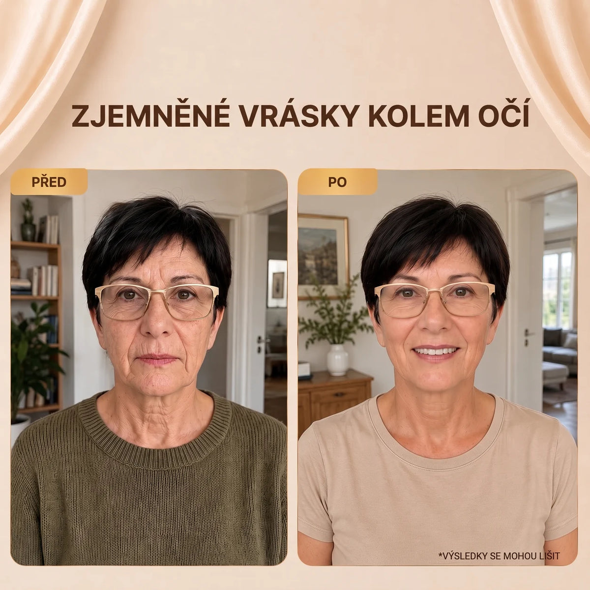 Zjemněné vrásky kolem očí