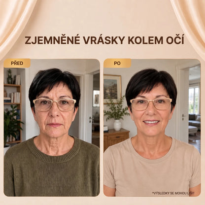 Zjemněné vrásky kolem očí